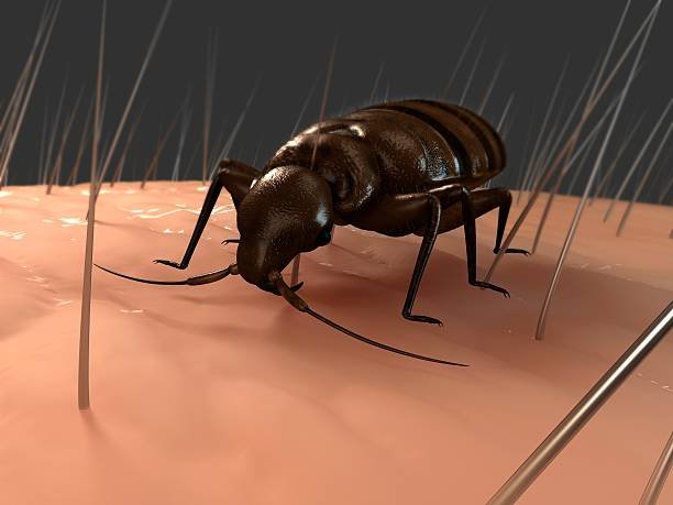 Can Bed Bugs Live in Your Hair